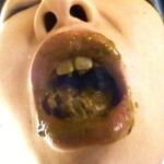 VRXM-009 エログロドキュメント ウンゲロミミズ ウンゲロミミズ… 嘔吐 Scat 井口昇 Ｖ＆Ｒプランニング