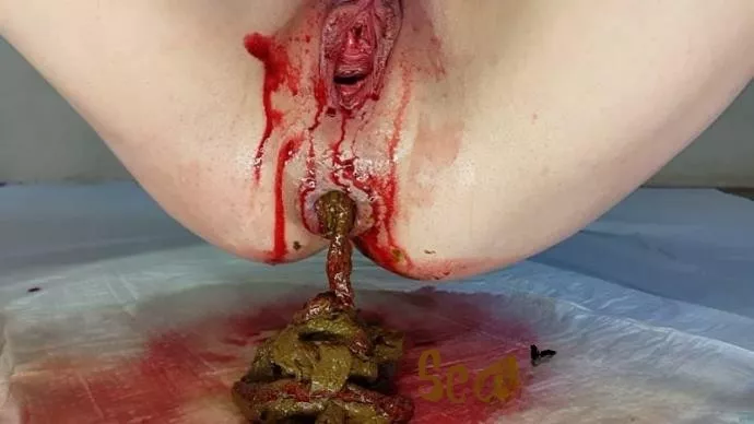 AnnaCoprofield Shit and Blood Vol.3
